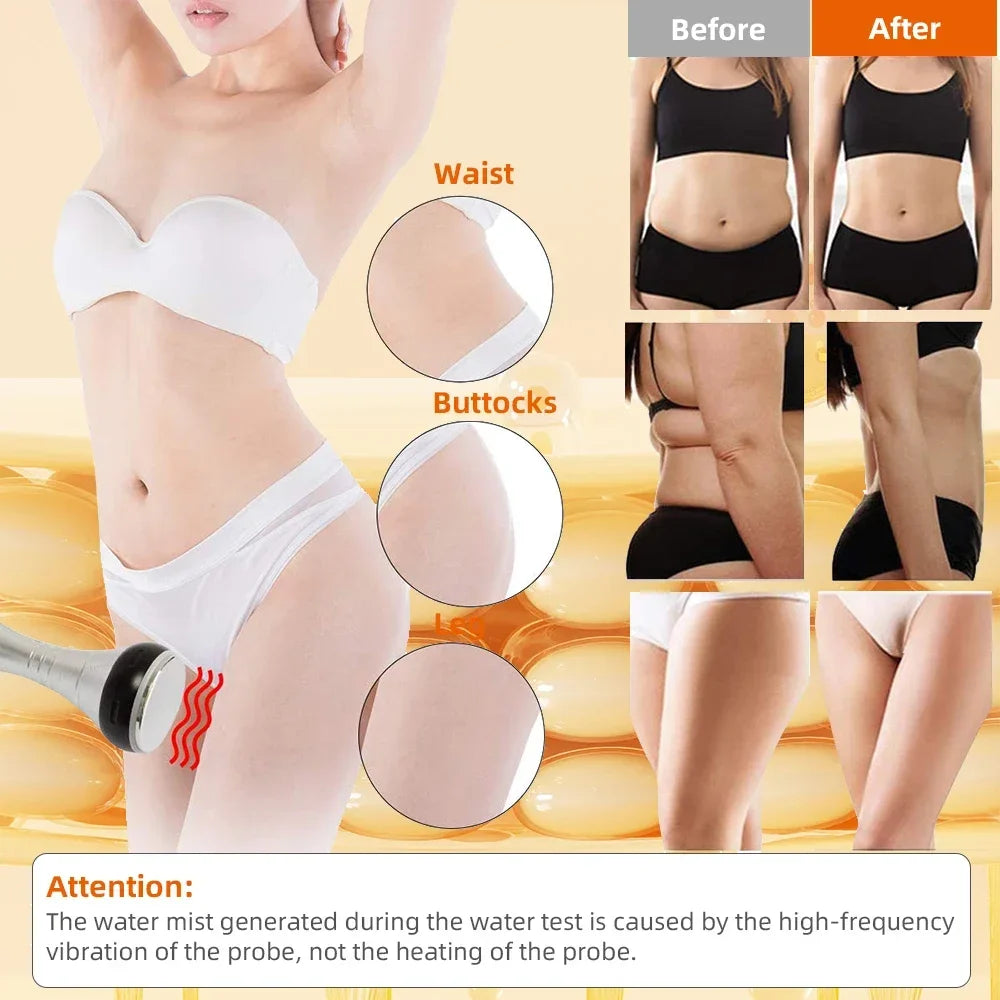 Lumevia™ 6-in-1 Cavitation RF Body Sculpting & Skin Tightening Machine