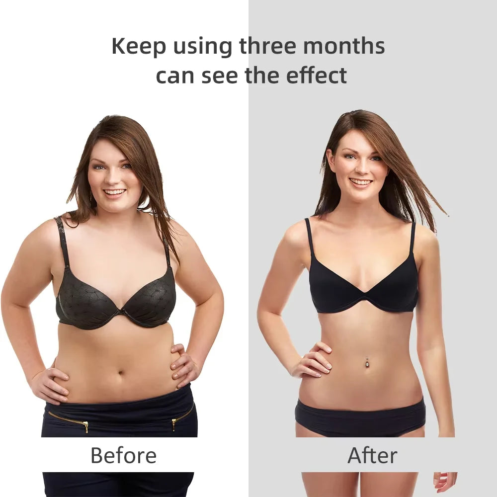 Lumevia™ RF Body Sculpting & Skin Tightening Massager – Slimming, Fat Burning & Firming Device